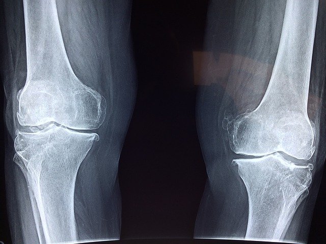bone-injury