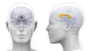 traumatic brain damage