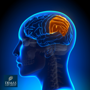 traumatic brain injury